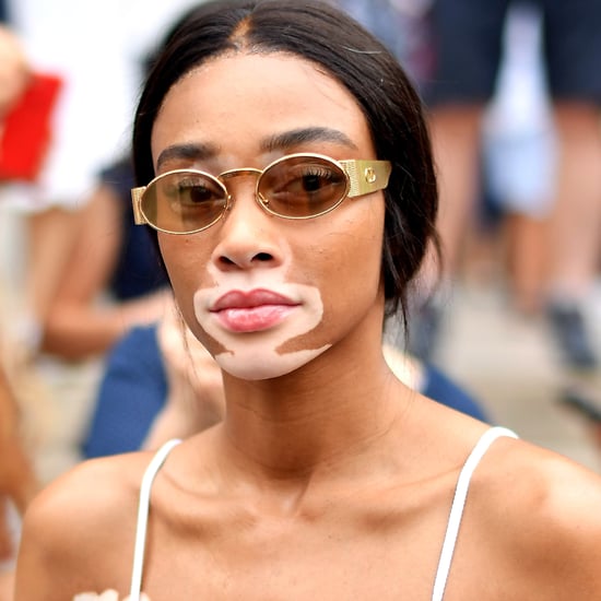 Winnie Harlow Tweet About Daily Mail July 2018