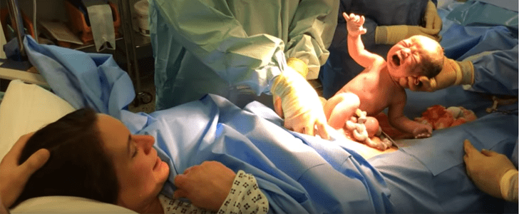 Baby Delivers Itself Via Natural C-Section Procedure