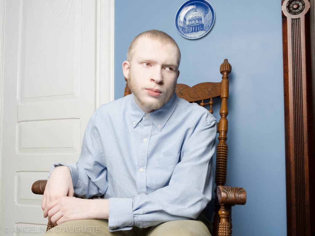 Albinism Photographs