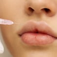 "Keyhole" Lip Filler Is Trendy but Controversial — Here's What You Should Know