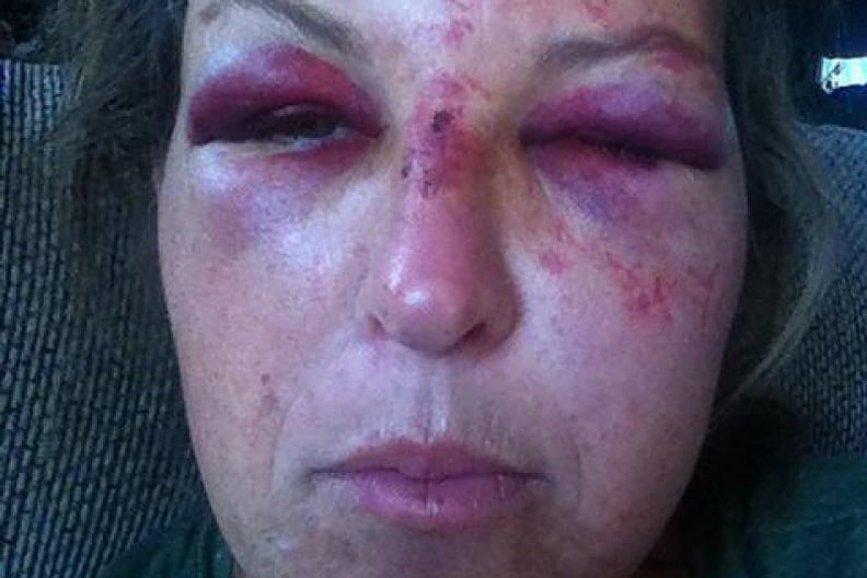 Day Care Worker Assaulted