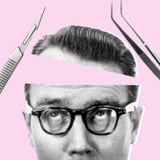 Hair Transplants Could Be Your Long-Lasting Solve to Hair Loss