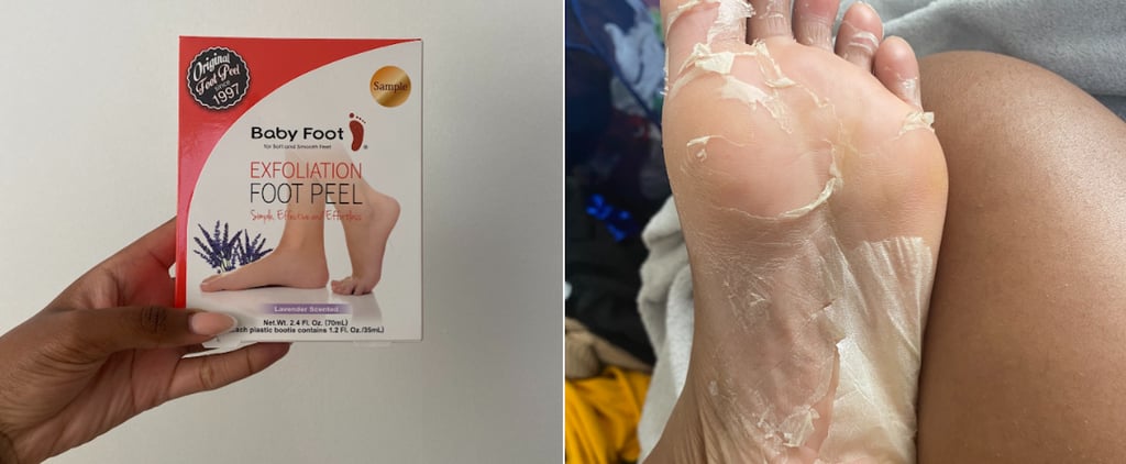 Baby Foot Peel Review With Photos