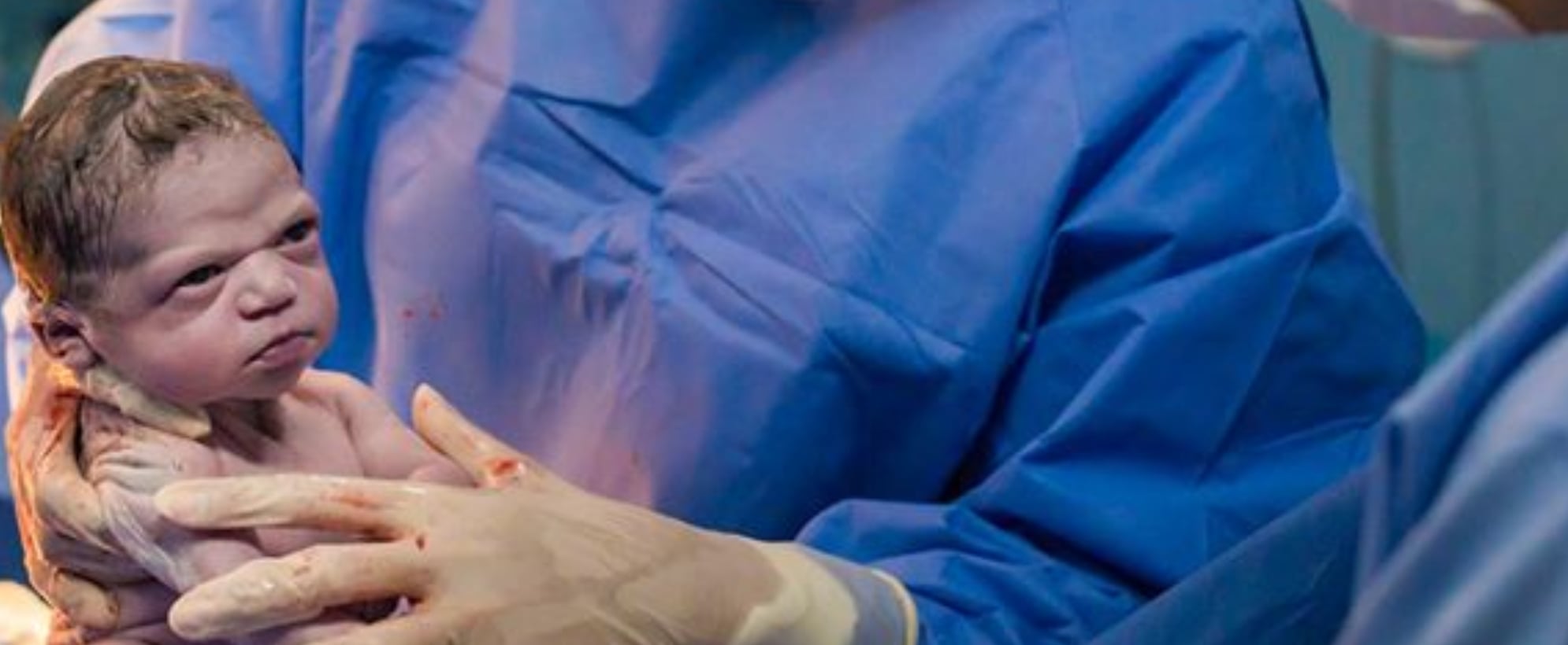 Newborn Baby Goes Viral For Making Hilarious Face At Birth