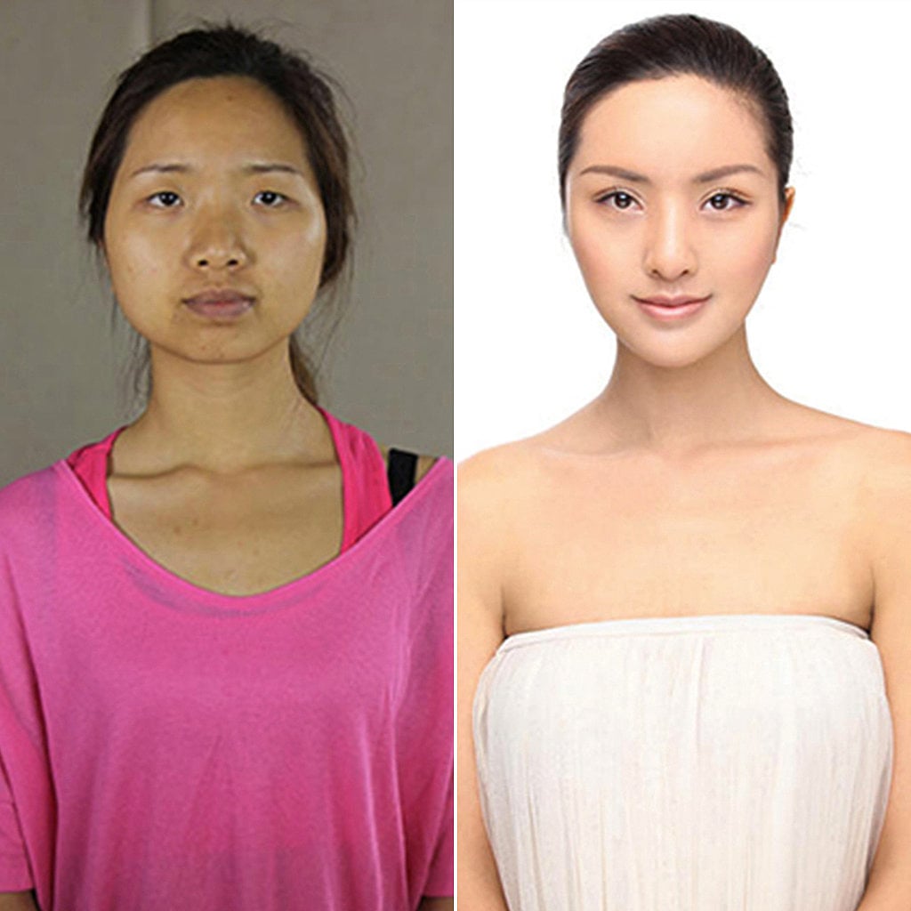 When Plastic Surgery Made These Women Unrecognizable