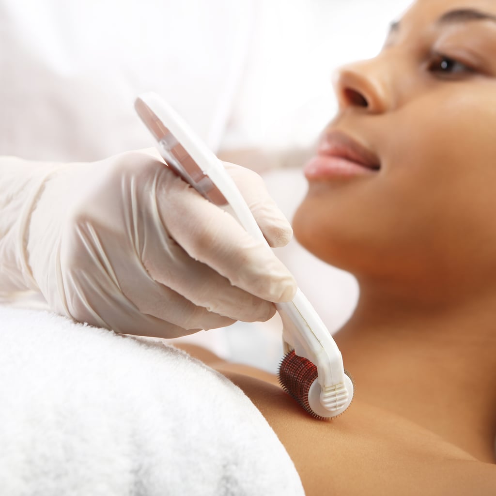 I Got Radiofrequency Microneedling — Here's What It Did For My Skin