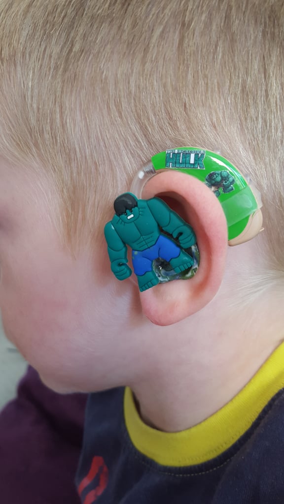 Mom Creates Superhero Hearing Aids For Son