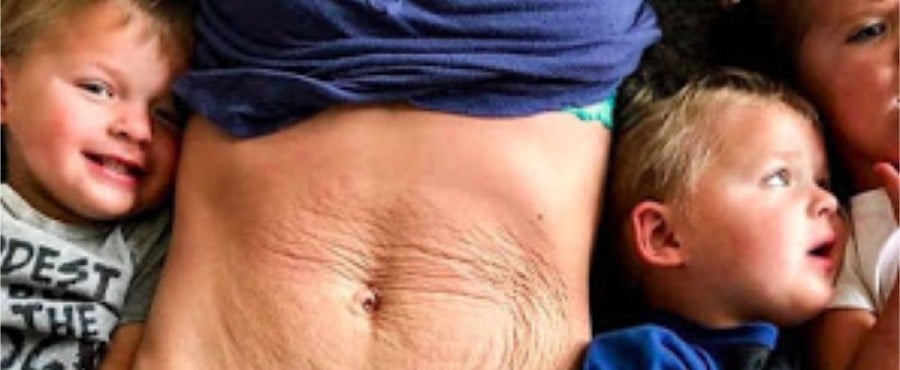 16 Times Women Got Brutally Honest About Why They Love Their Postpartum Bodies