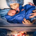 The Most Stunning C-Section Photos Birth Photographers Have Ever Taken