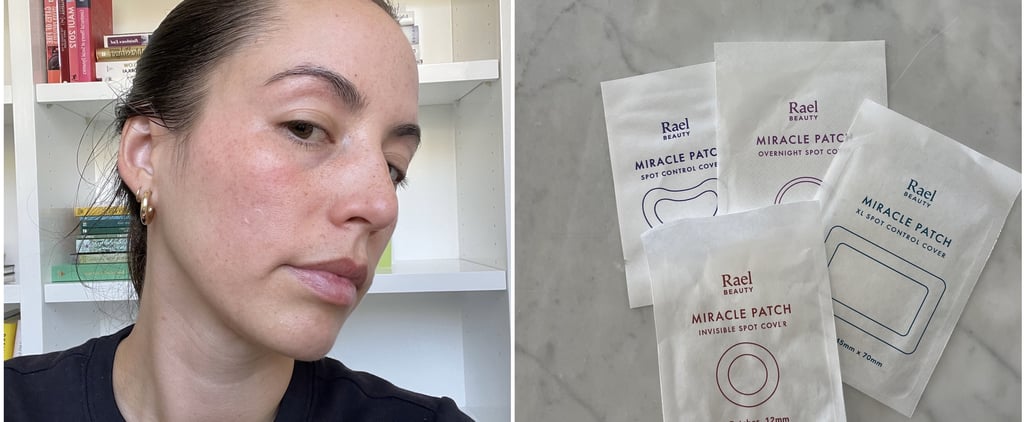 I Finally Found Pimple Patches That Actually Work For Me