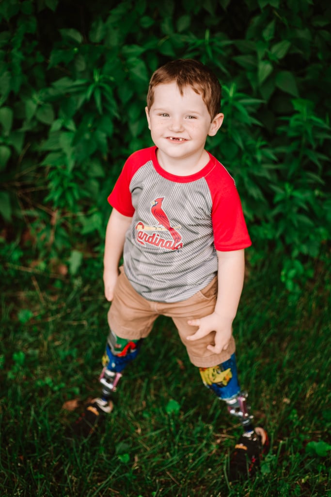 Photo Shoot of Toddler Who Lost Both Legs
