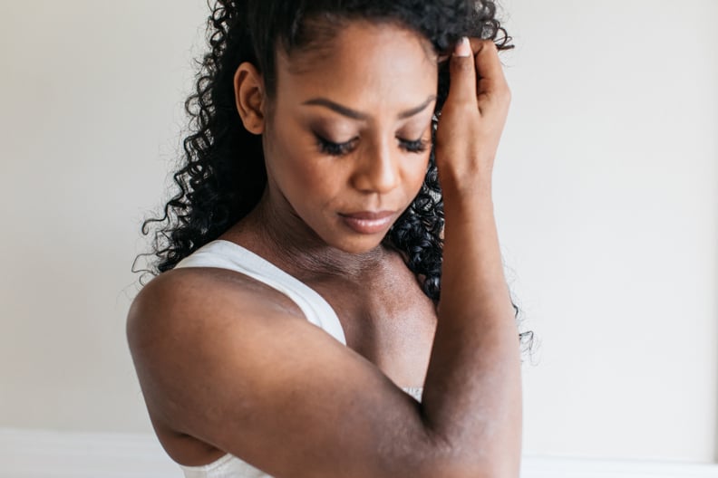 Taken from THIS IS my SKIN showcasing everyday people living honestly with eczema, psoriasis and dry skin conditions.