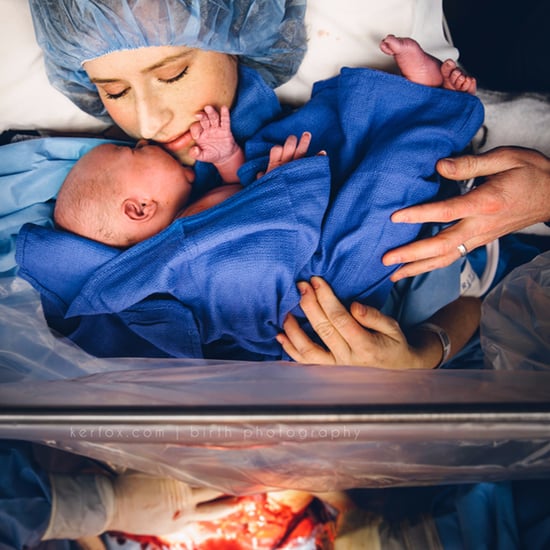 C-Section Birth Photography