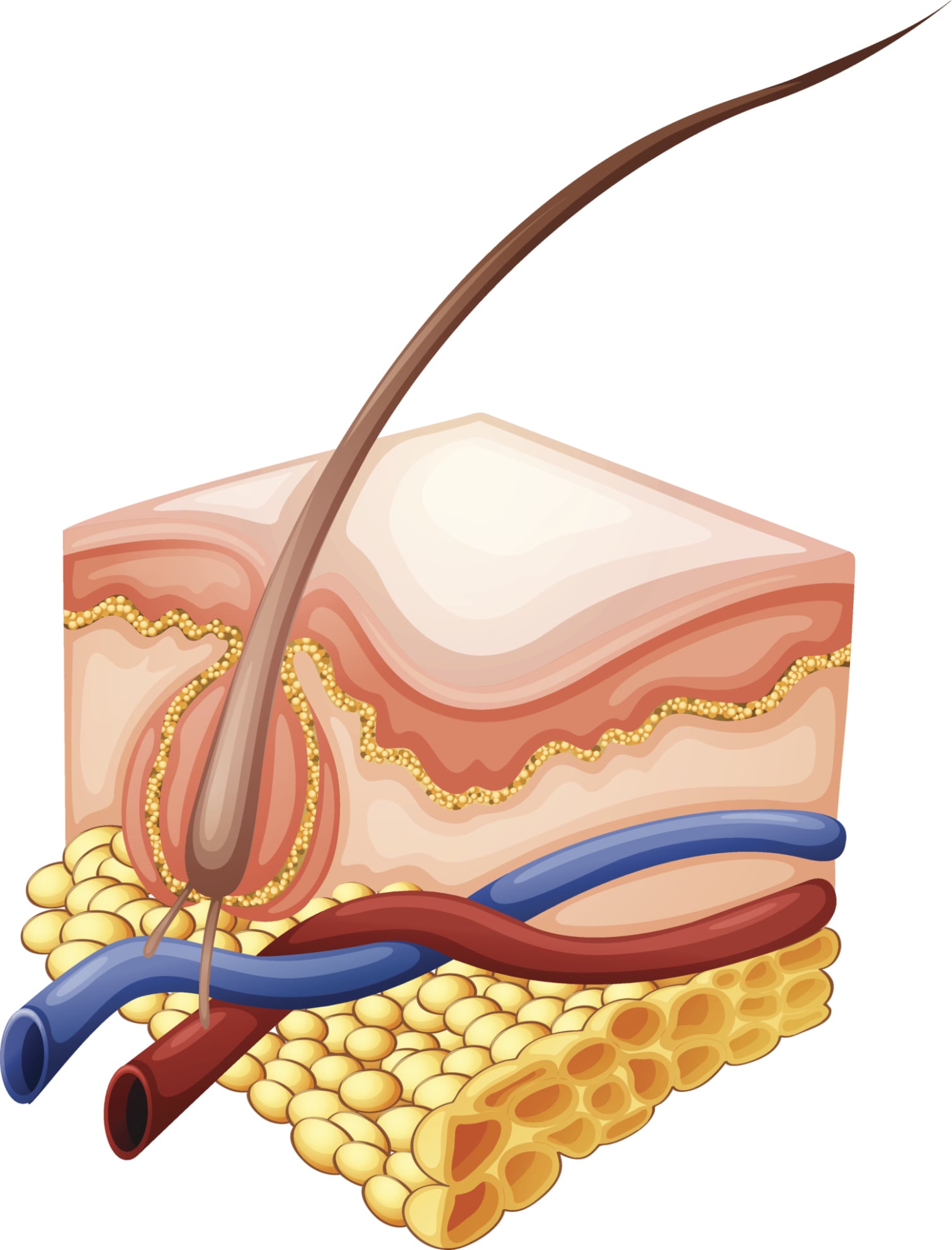 Should I Get Electrolysis? | POPSUGAR Beauty