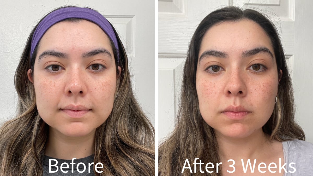 Bt-Sculpt Before and After 3 Weeks of Use