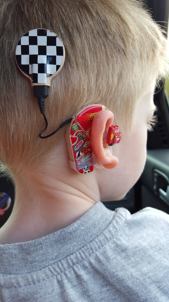 Mom Creates Superhero Hearing Aids For Son
