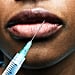 Preventative Botox Pros and Cons