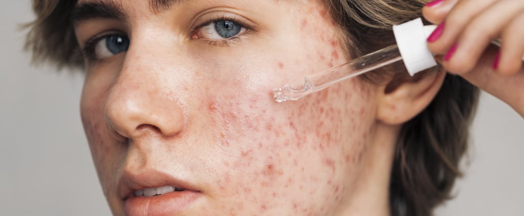 How to Unclog Pores, According to Doctors and Aestheticians