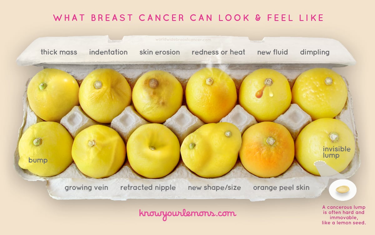 What Breast Cancer Can Look and Feel Like Photo | POPSUGAR ...