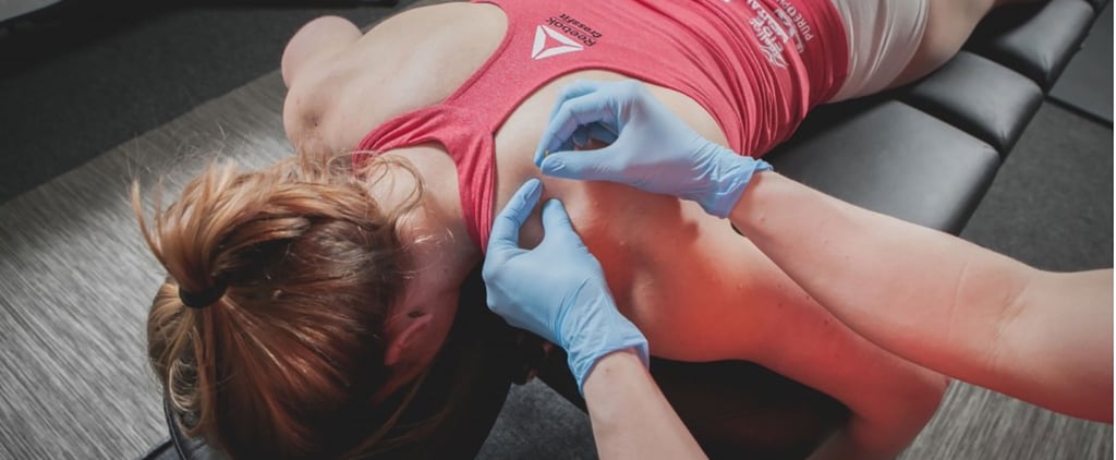 What Is Dry Needling? Everything You Need to Know About This Pain-Relieving Technique