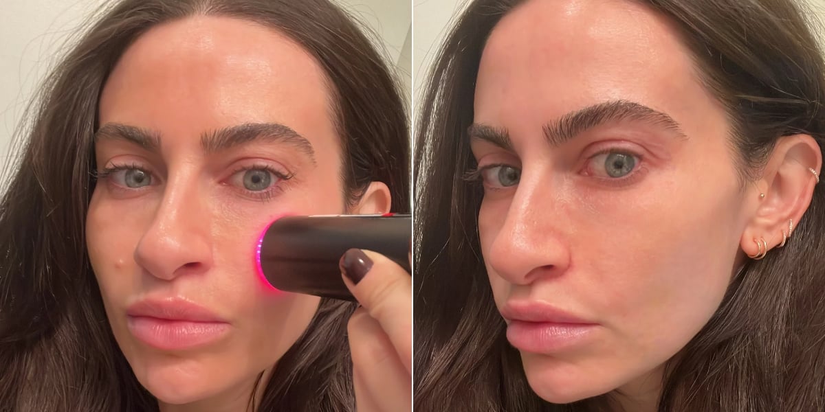 I Tried the $2,700 At-Home Laser Celebrities Swear By
