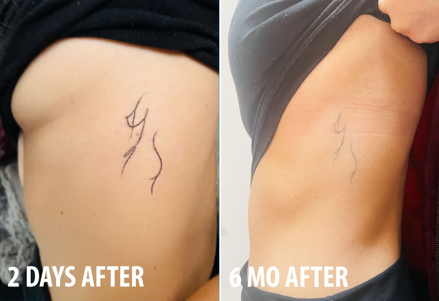 I Got An Ephemeral Tattoo: See Photos of Ink Fading Process | POPSUGAR  Beauty