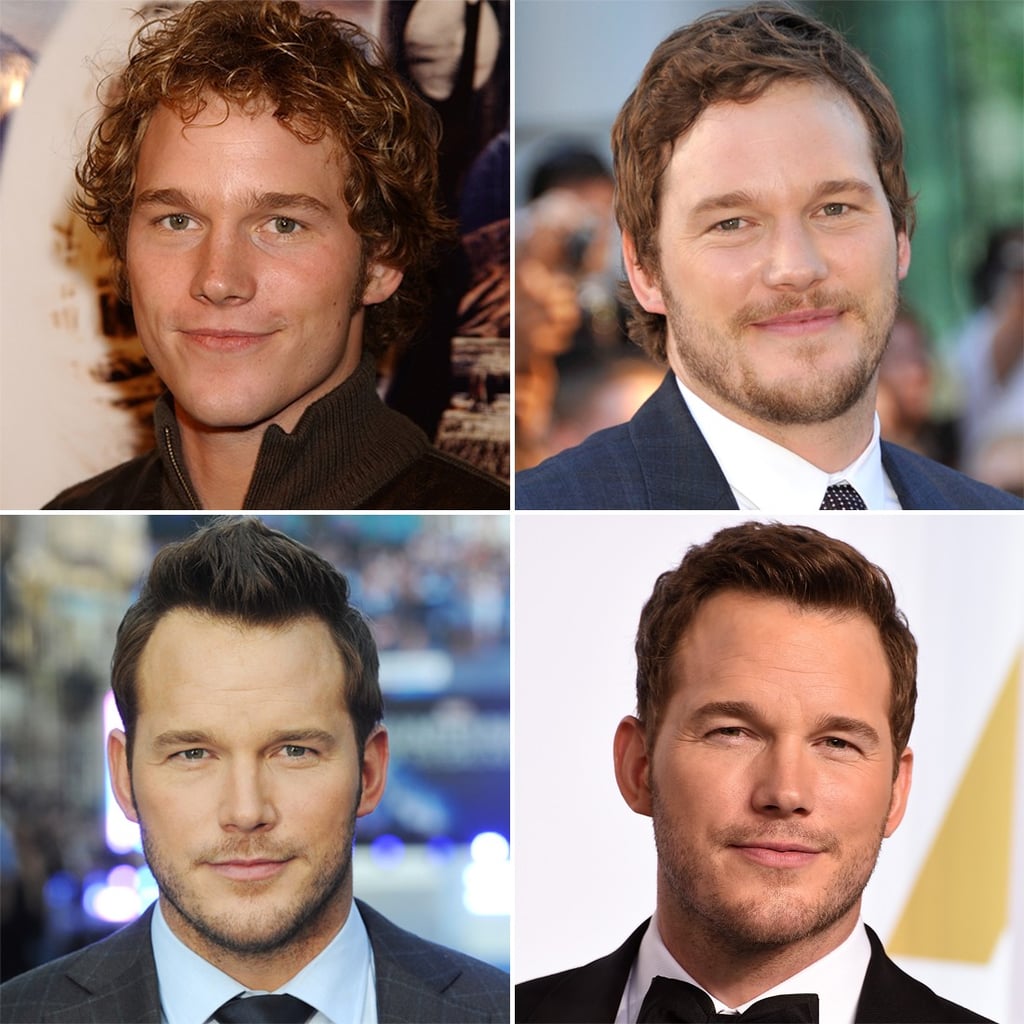 Chris pratt hair transplant