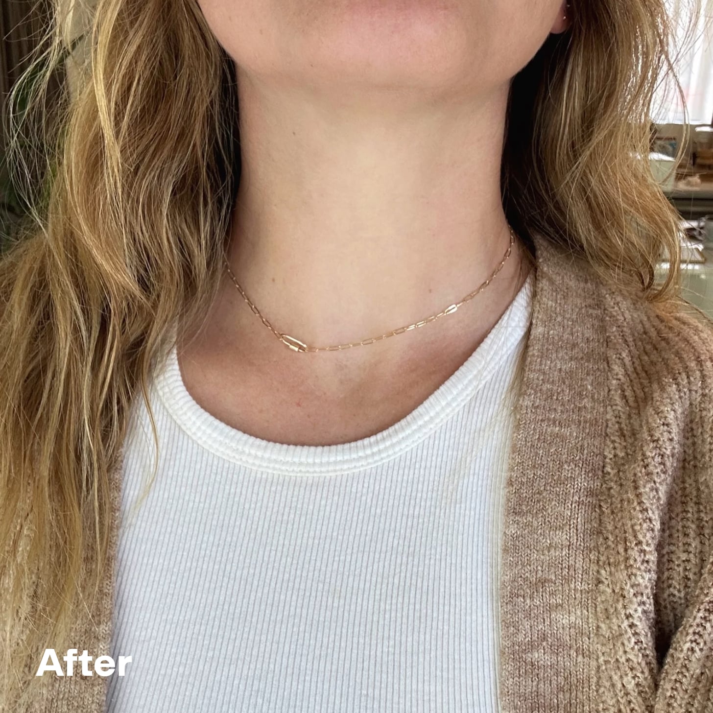 Neck Botox Editor Experiment