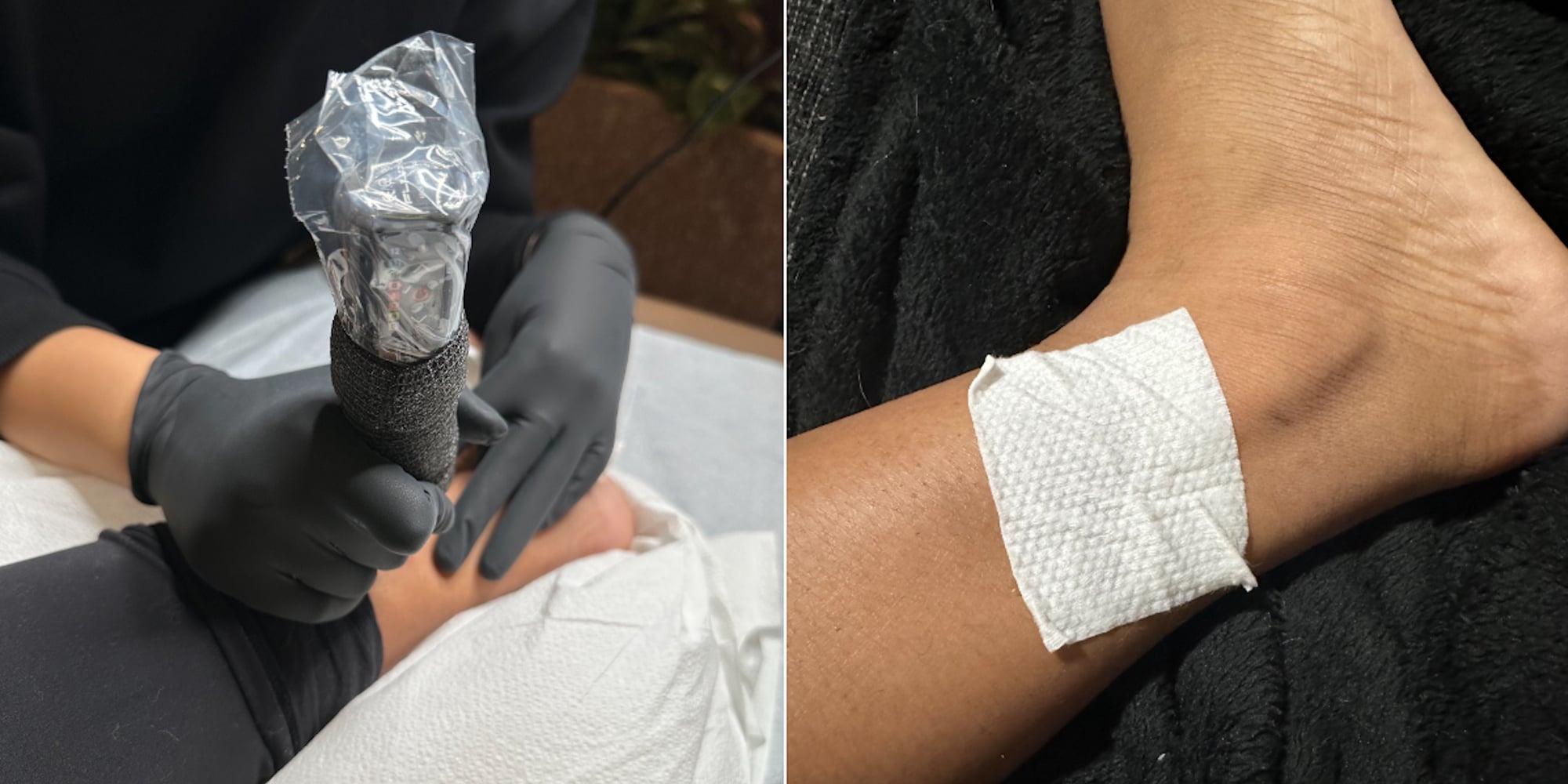 Mad Rabbit Tattoo Repair Patch Works Magic