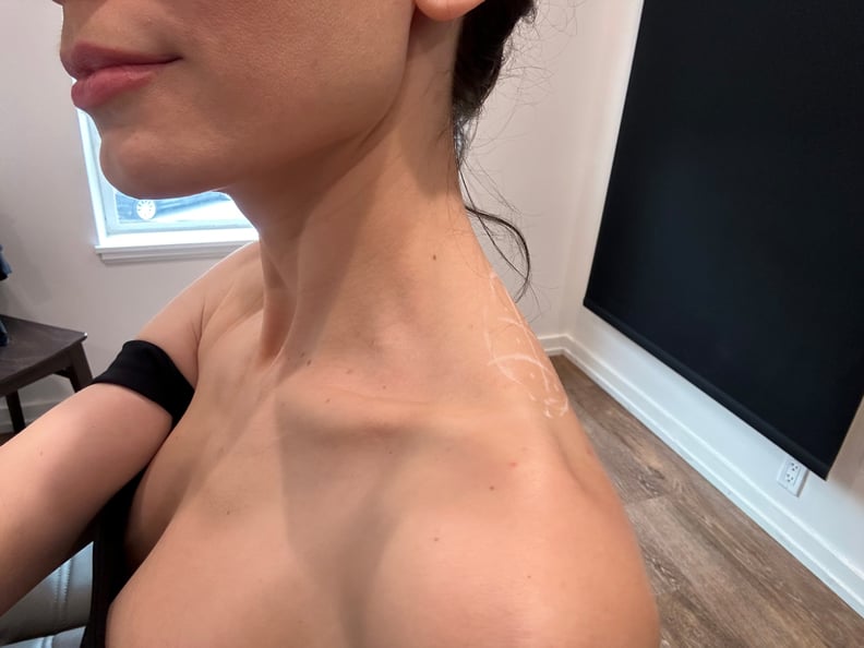 Plastic surgeon weighs in on beauty trend 'traptox' - which sees