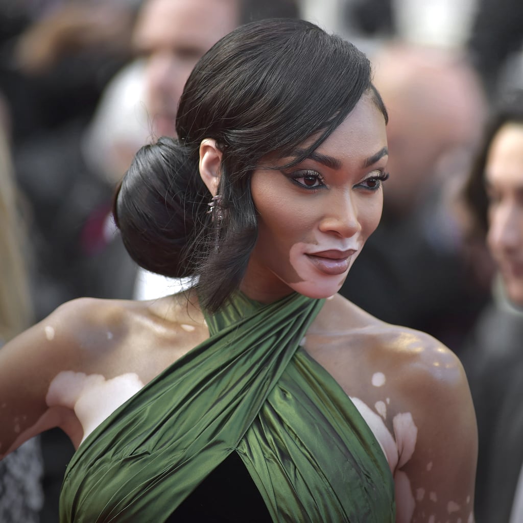 Winnie Harlow Gets Boyfriend Kyle Kuzma's Name Tattooed Behind Her Ear