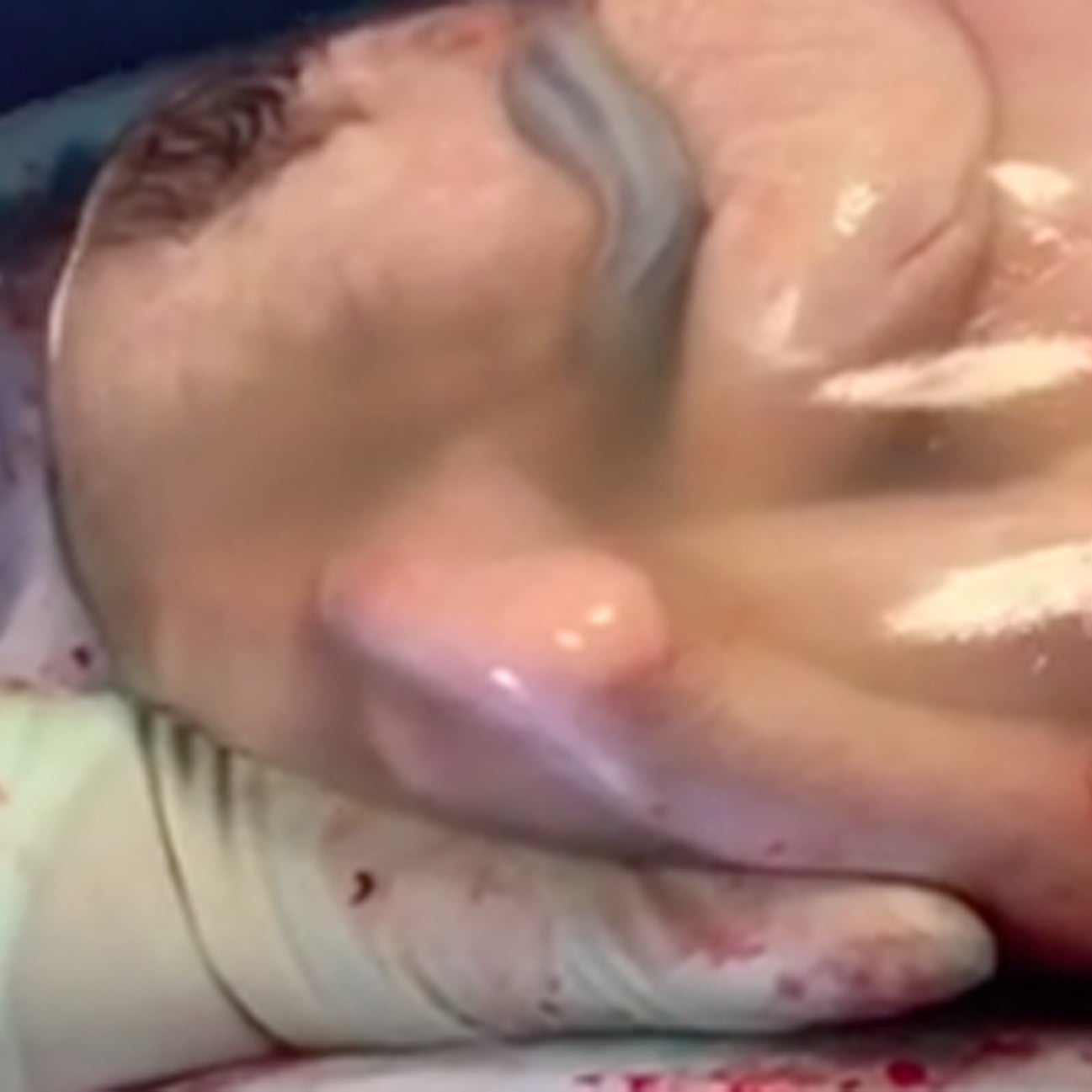 Video Of A Triplet Being Born En Caul Popsugar Family