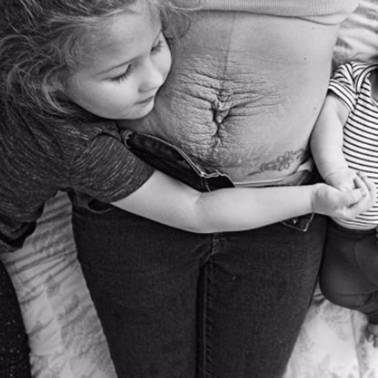 Pressure to Have the "Perfect" Body Postpartum