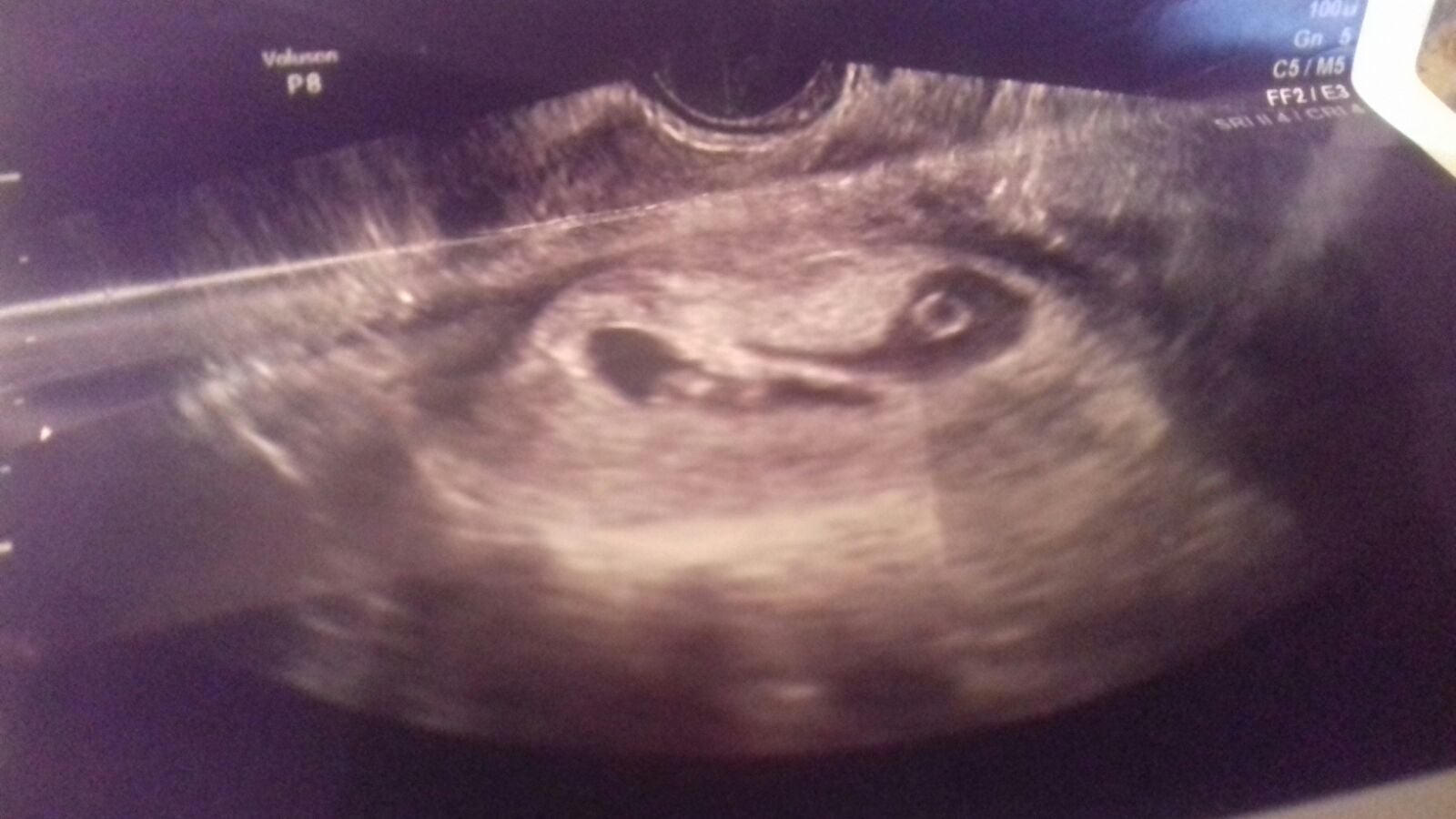 how do i view my sonogram with efilm lite how do i view my sonogram with efilm lite