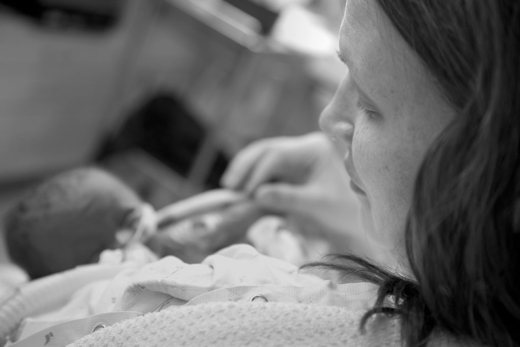 Trisomy 13 and 18 Baby Photos