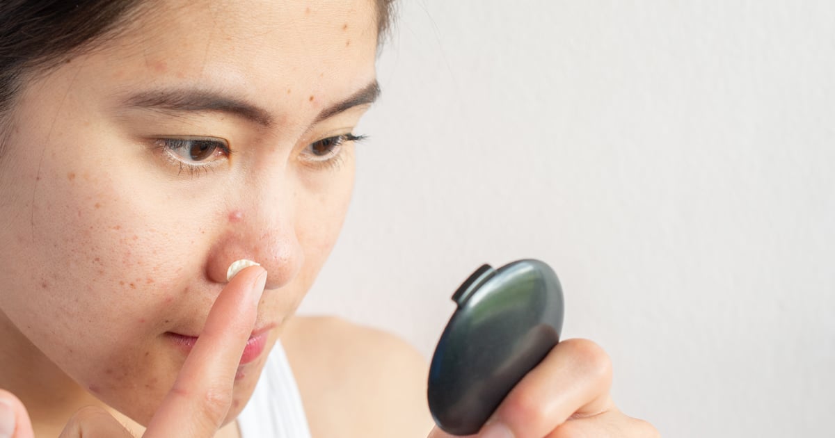 PCOS And Acne Dermatologists Explain Causes And Treatments POPSUGAR