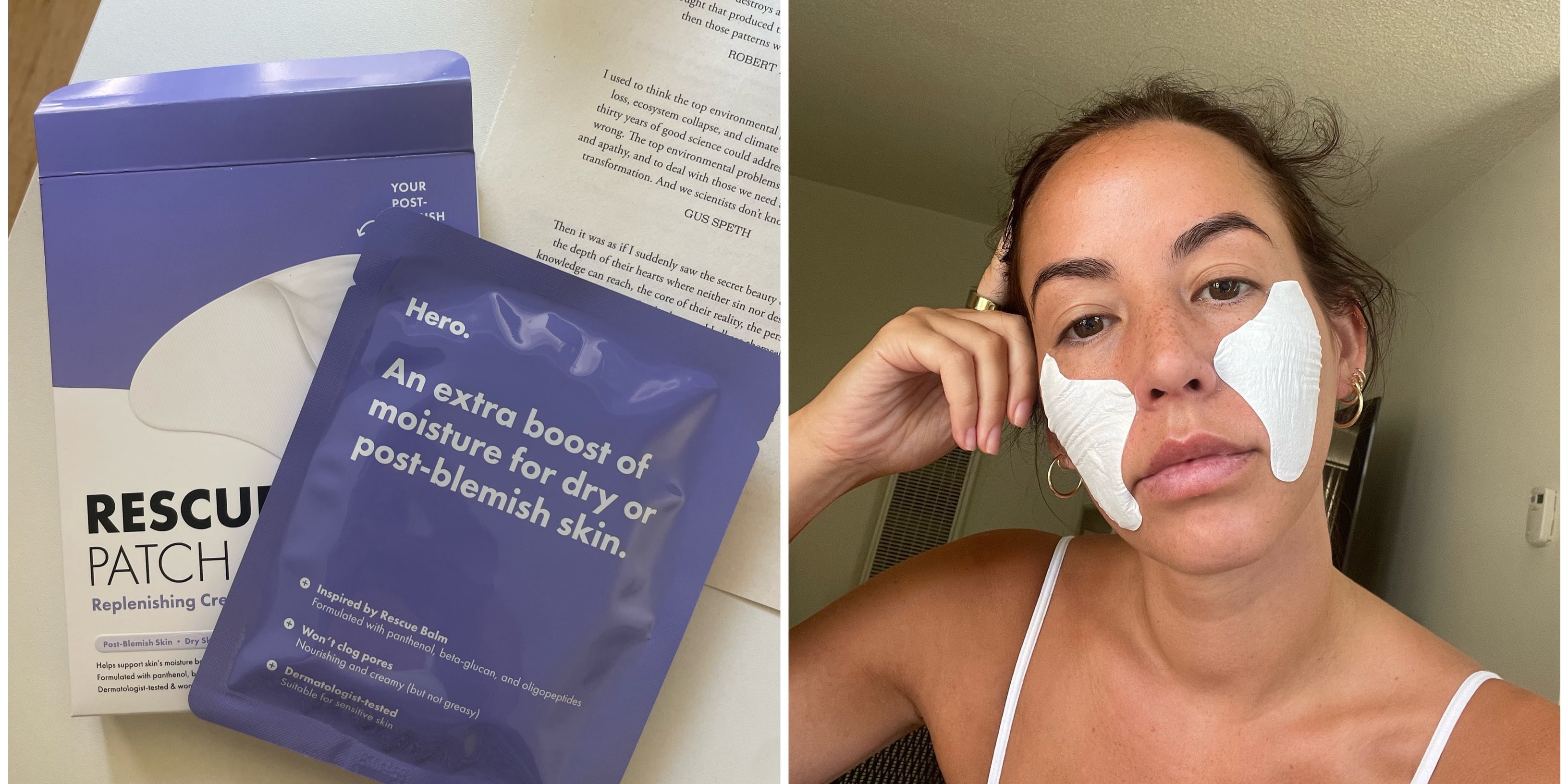 This $18 Acne Recovery Patch Is Perfect For Your Back-to-School Skin-Care Routine