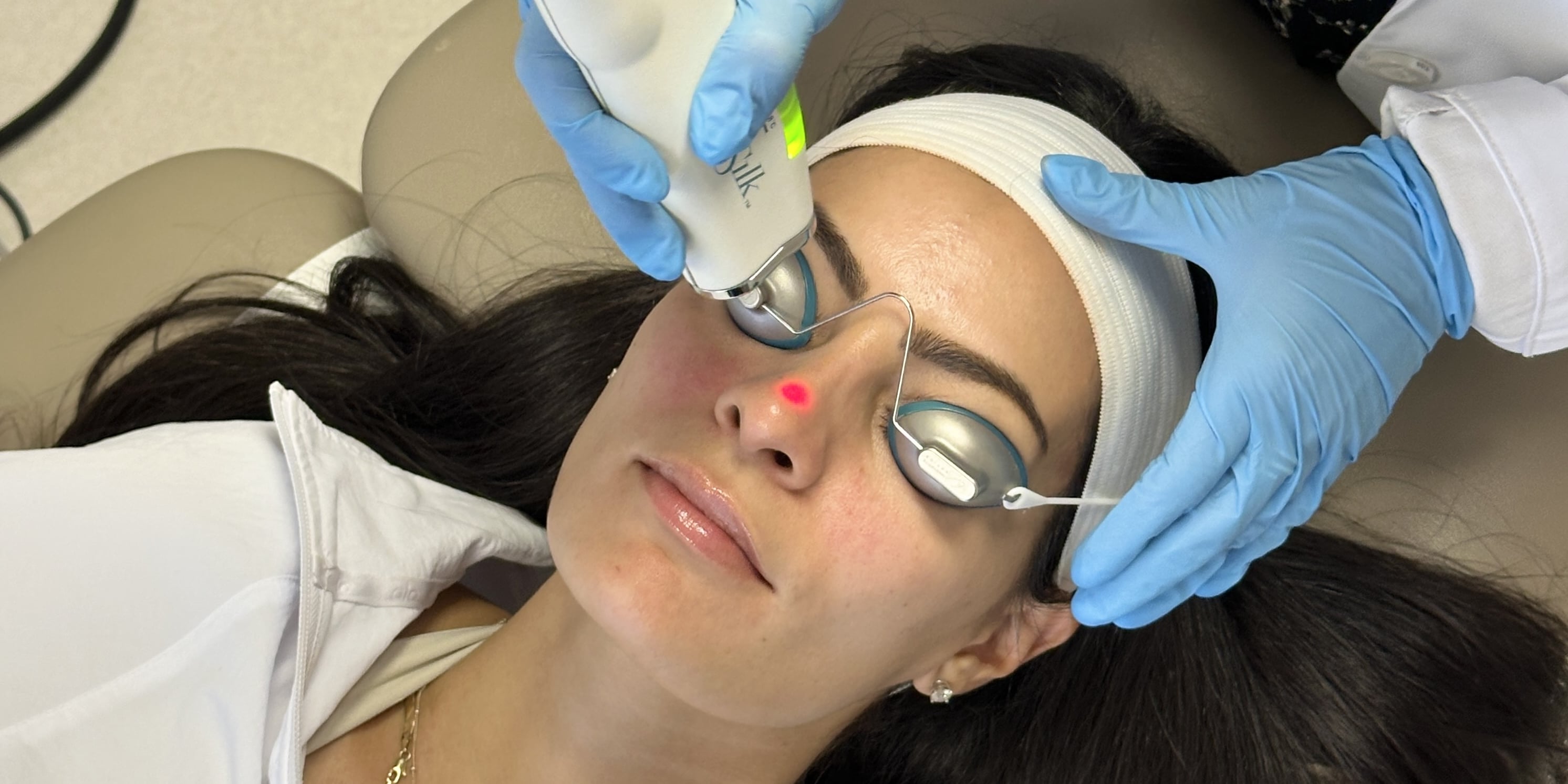 I Tried the ClearSilk "Lunchbreak" Laser For My Rosacea — See My Results