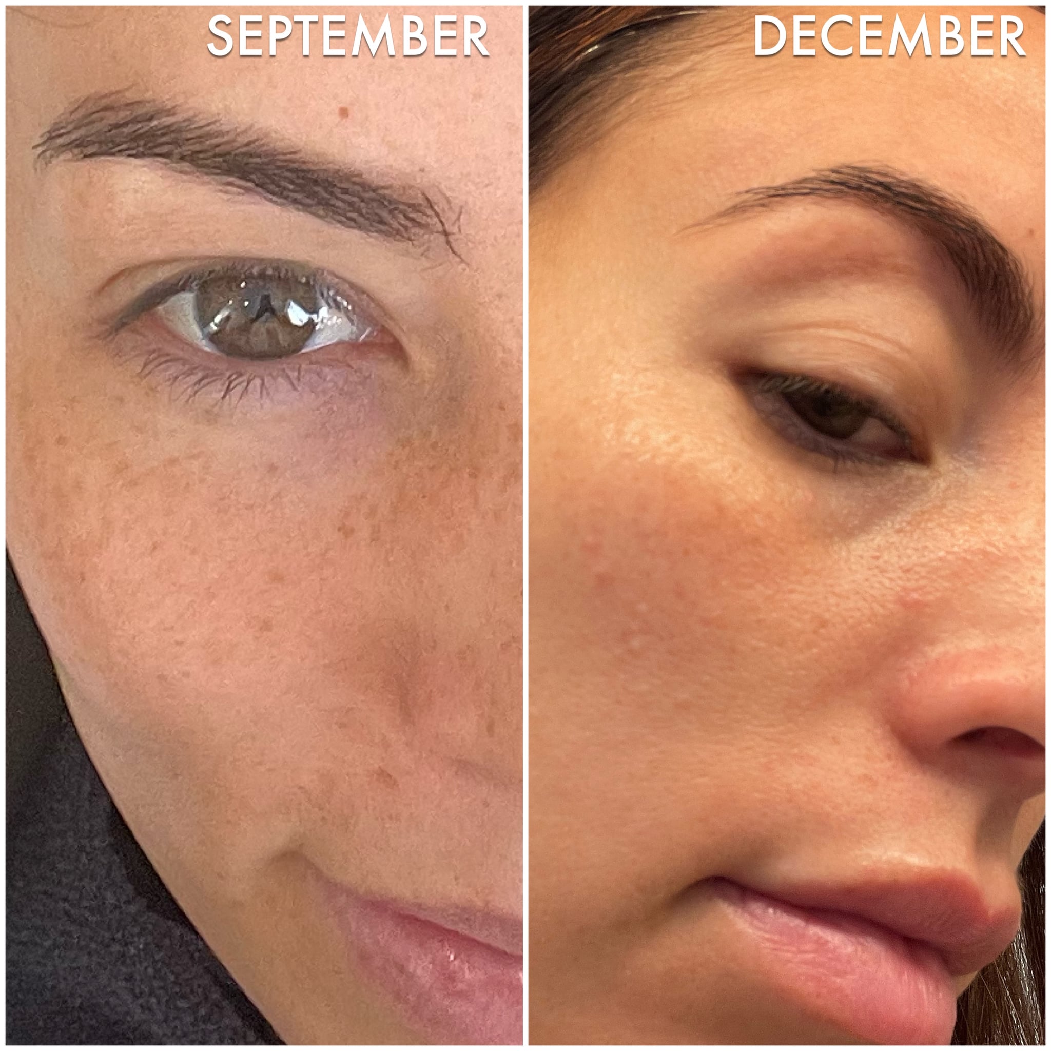Mother Science Molecular Hero Serum Review