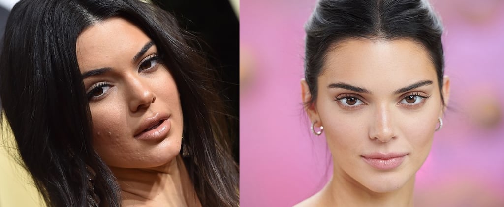 Kendall Jenner Proactiv 2019