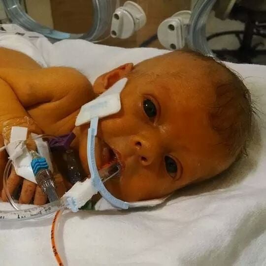 The original photo of baby Sophia. 
Source: Reddit user steffel07 via Imgur