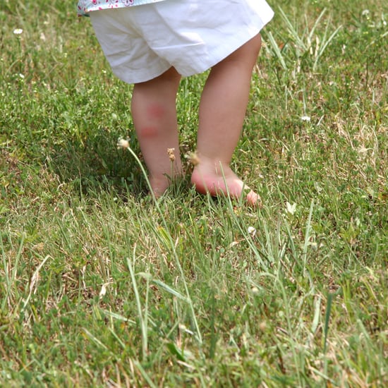 Mom Diagnoses Son's Lyme Disease From a Facebook Photo