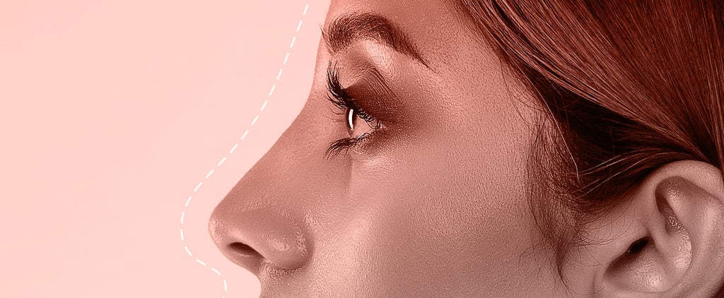 "Tip Lift" Nose Job Procedure: Recovery, Before-and-Afters
