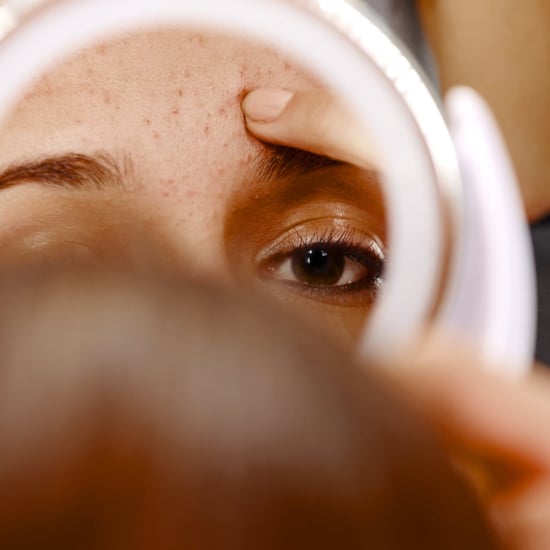 Is That a Pimple or an Ingrown Hair? Here's the Difference