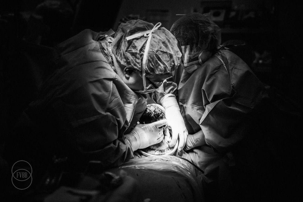 C-Section Birth Photography