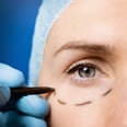 What Is the "One Stitch" Facelift?