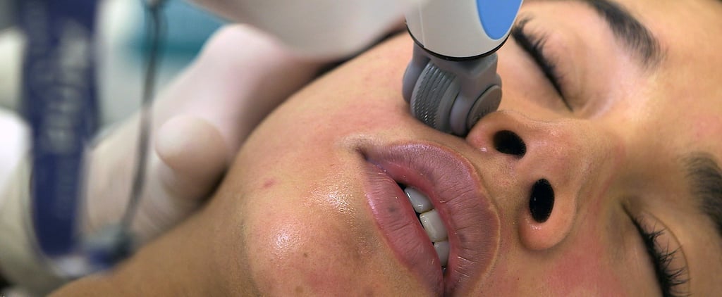 Hannah Bronfman Microneedling Facial | Video