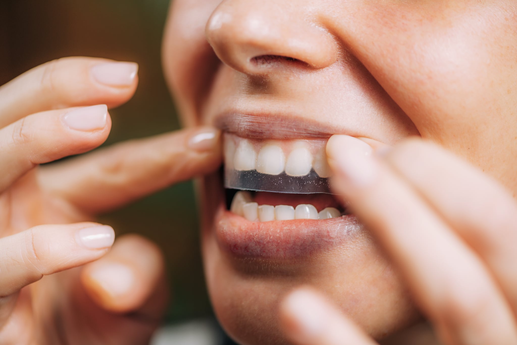 Teeth whitening strips are one way to whiten teeth at home