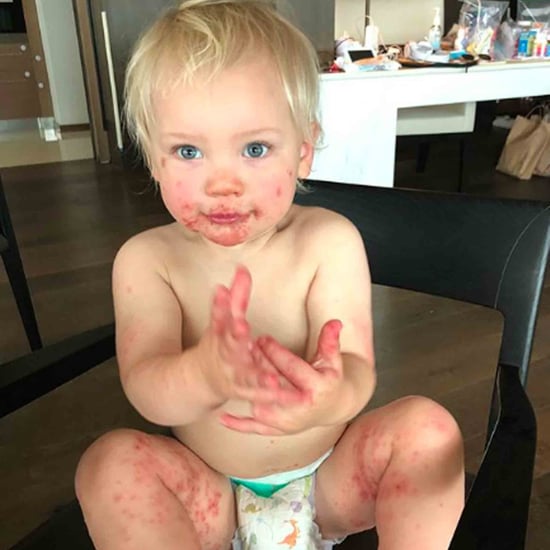 Pink's Son Got Hand-Foot-and-Mouth Disease While on Tour
