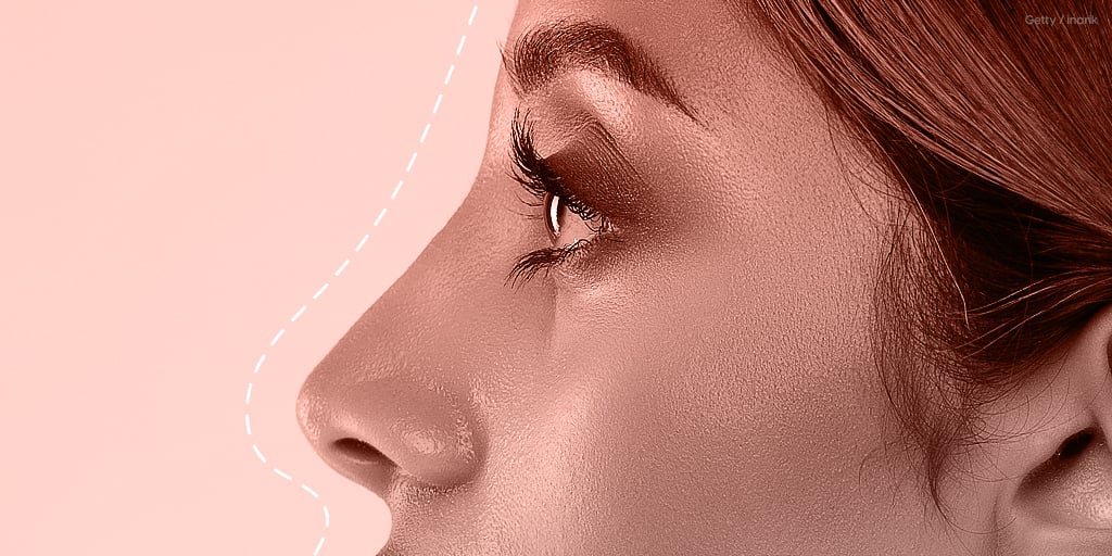 "Tip Lift" Nose Job Procedure Recovery, BeforeandAfters POPSUGAR